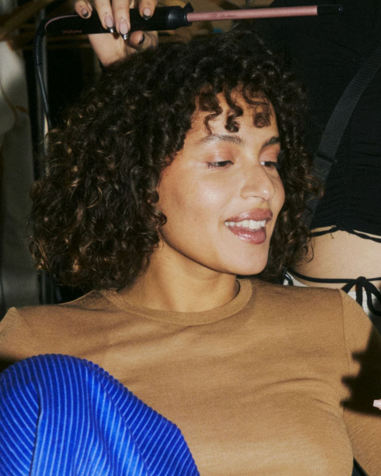 Woman with Chronic Dandruff