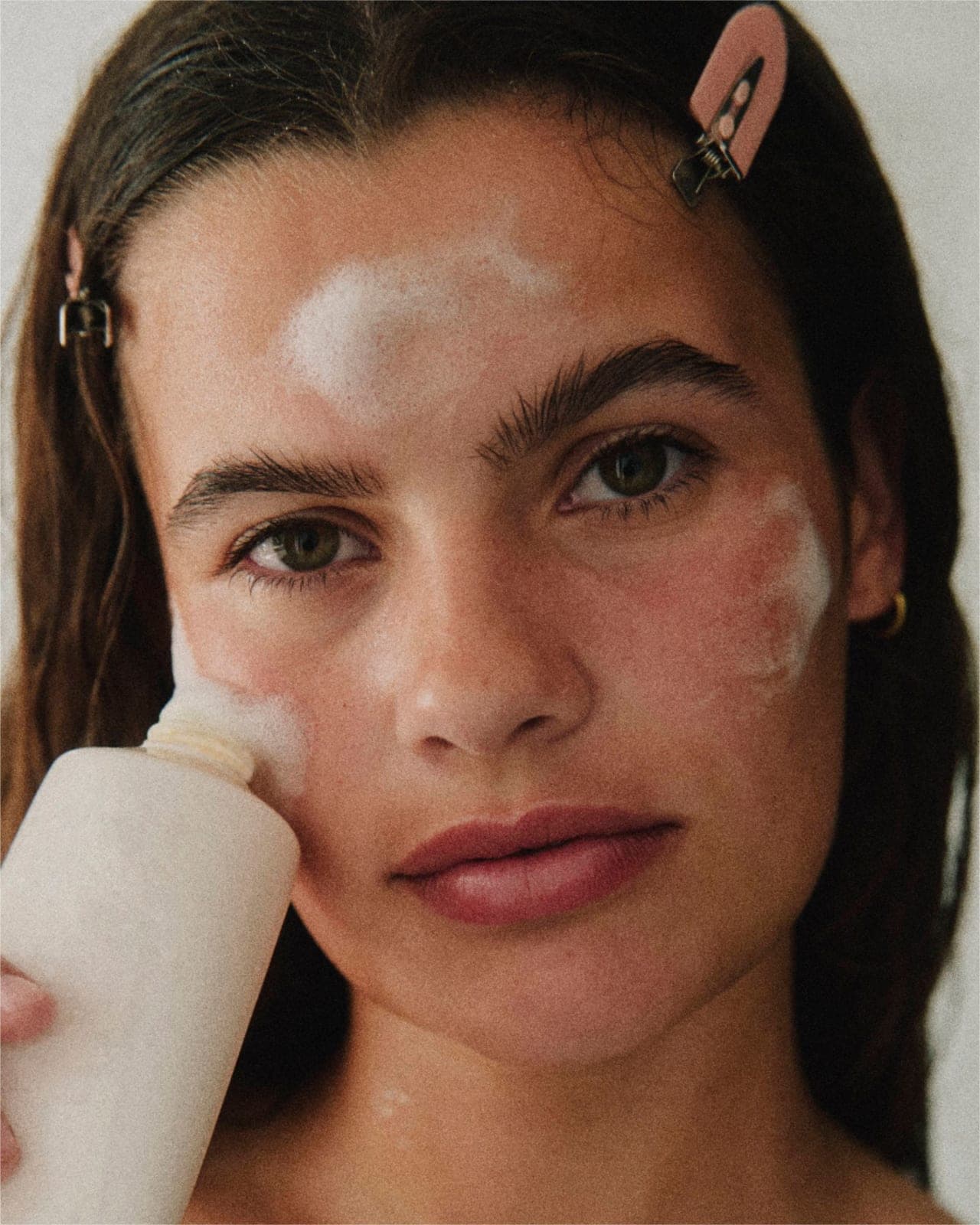A woman with Acne