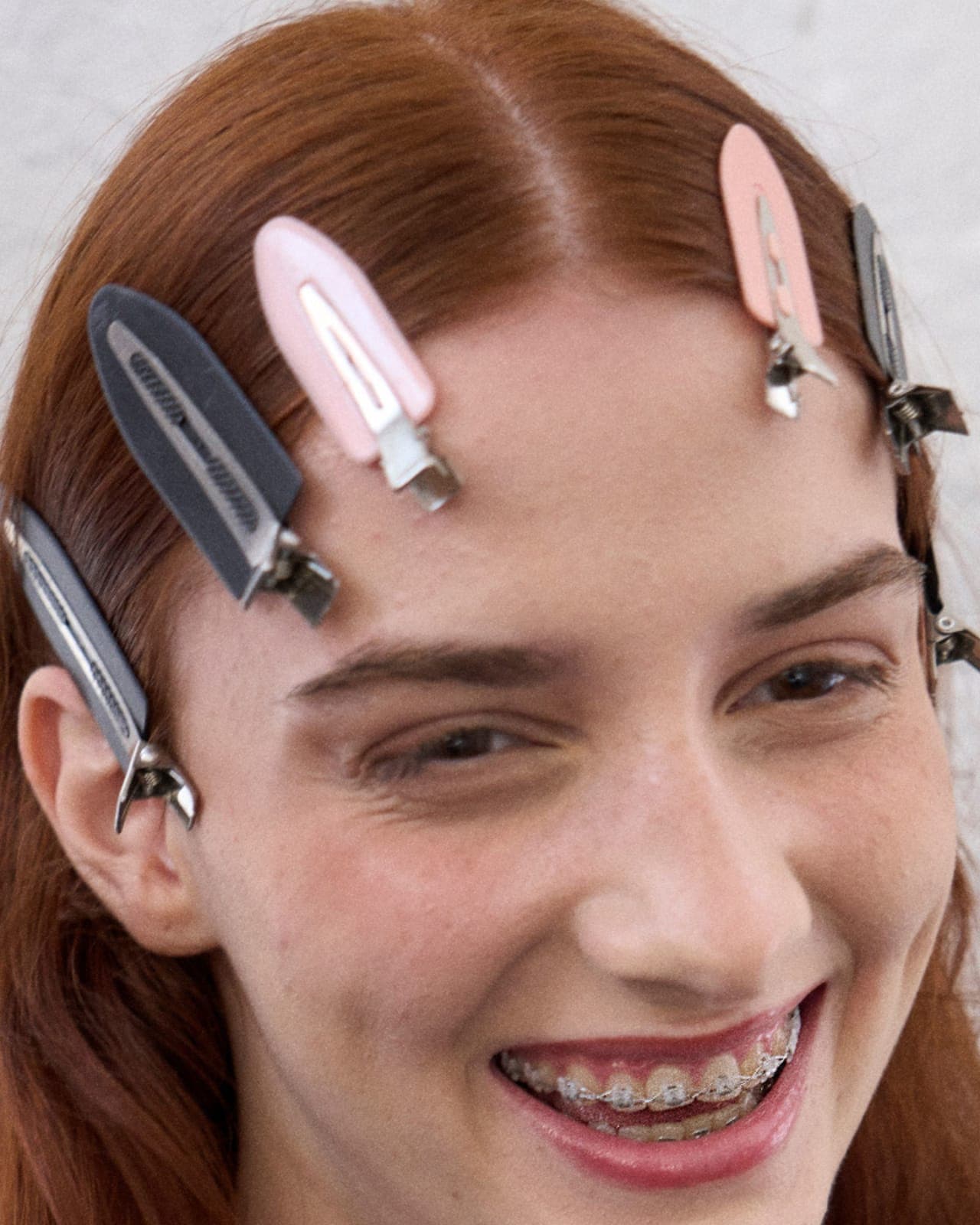 Persistent scalp scaling