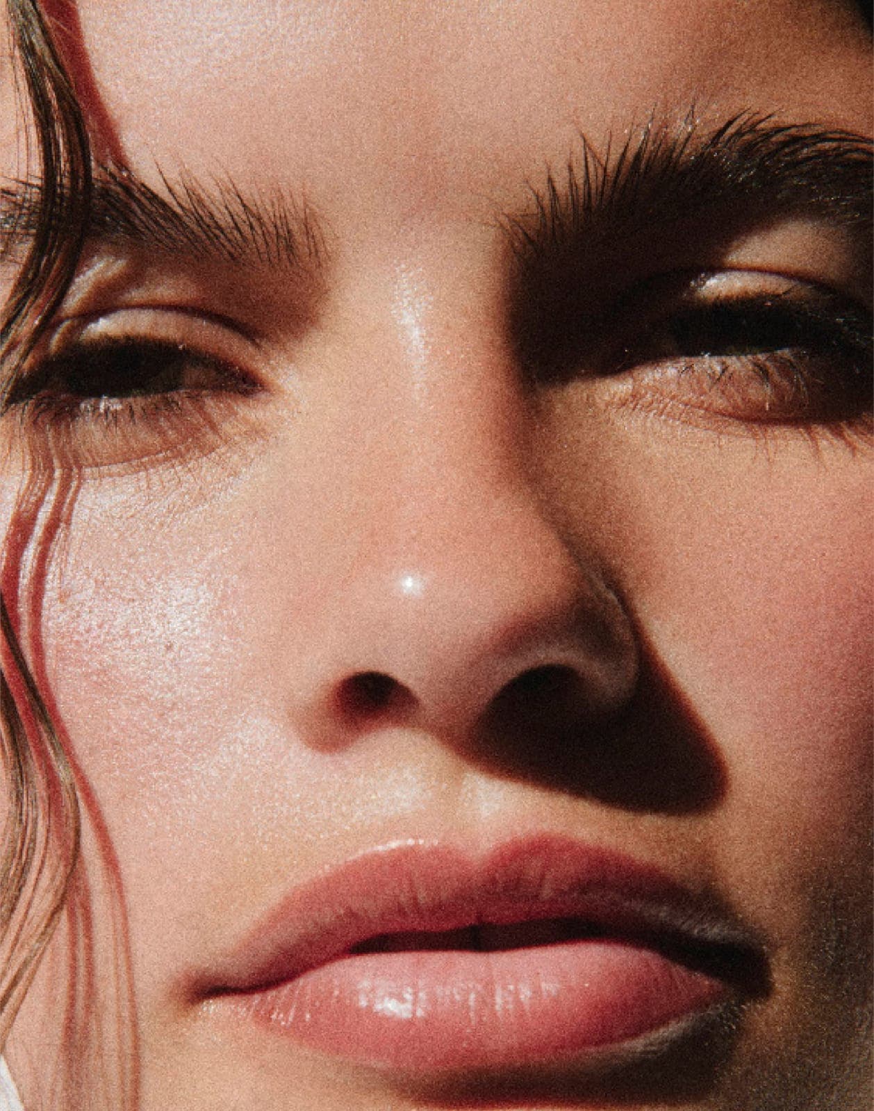 Cystic acne